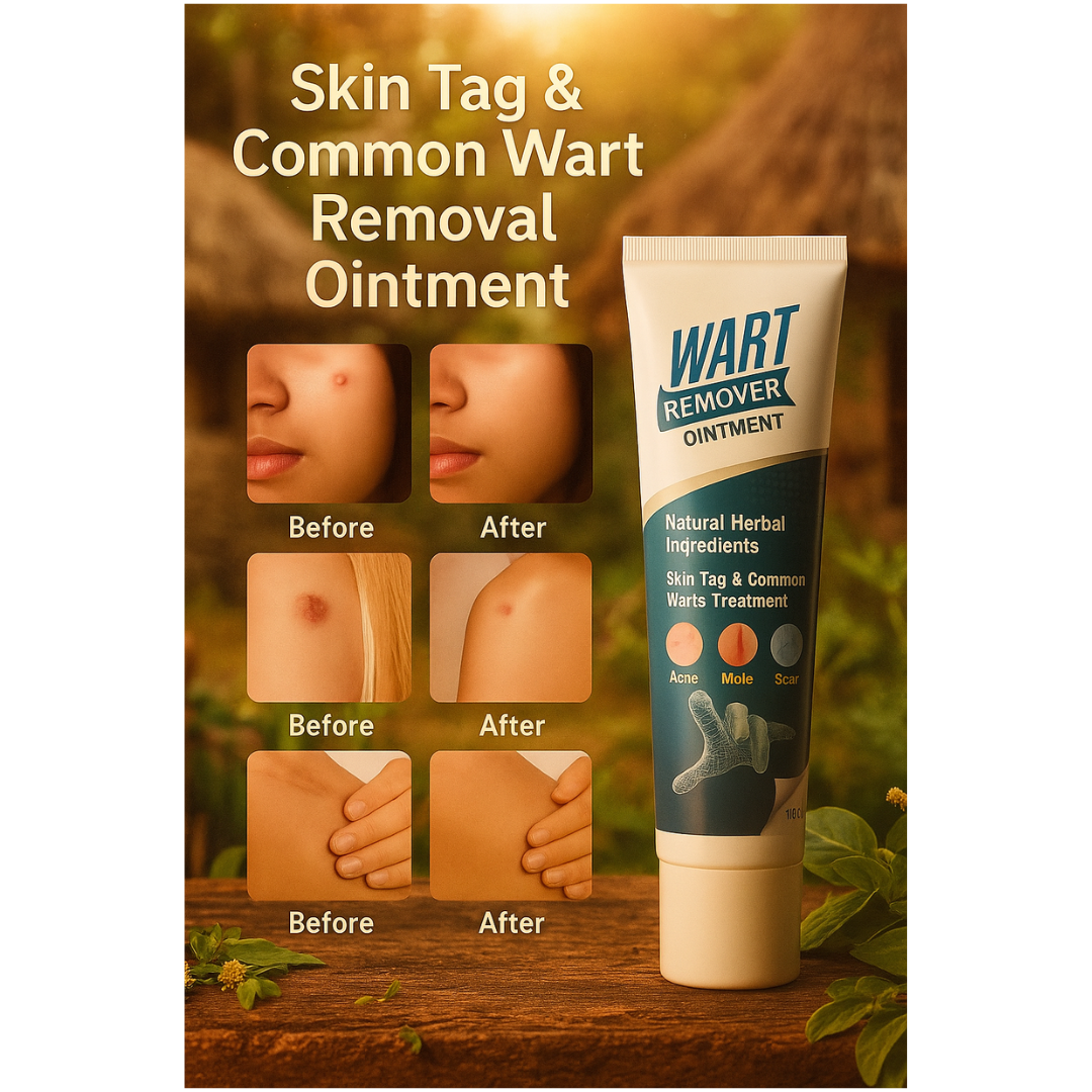 Warts Remover Cream